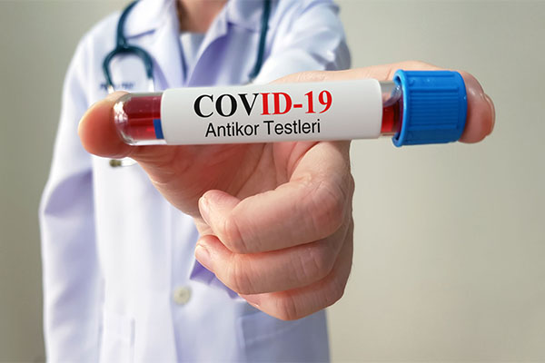 Covid-19 Antikor Testi